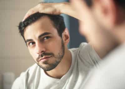 Man Worried For Alopecia Checking Hair For Loss